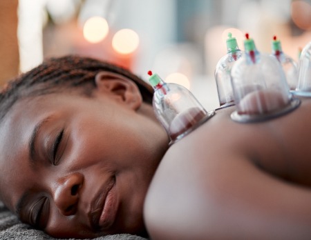 Cupping