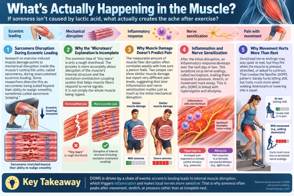Infographic explaining muscle damage, inflammation, and nerve sensitization that cause soreness after exercise.